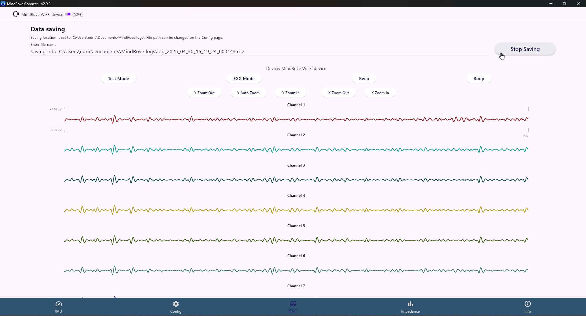Signal Processing